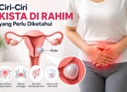 Ciri-Ciri Kista di Rahim yang Sering Tidak Disadari, Kenali Gejalanya Sejak Dini