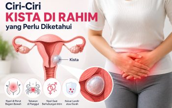 Ciri-Ciri Kista di Rahim yang Sering Tidak Disadari, Kenali Gejalanya Sejak Dini