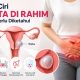 Ciri-Ciri Kista di Rahim yang Sering Tidak Disadari, Kenali Gejalanya Sejak Dini