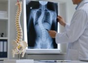 Apa Itu Skoliosis: Penyebab, Gejala, Diagnosis, dan Cara Mengatasinya
