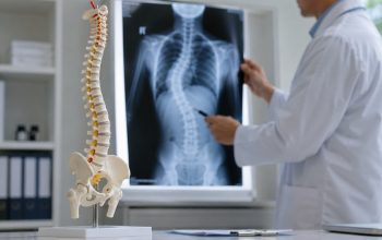 Apa Itu Skoliosis: Penyebab, Gejala, Diagnosis, dan Cara Mengatasinya
