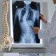 Apa Itu Skoliosis: Penyebab, Gejala, Diagnosis, dan Cara Mengatasinya