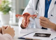 Apa Itu PCOS Pada Wanita? Penyebab, Gejala, dan Cara Mengatasinya