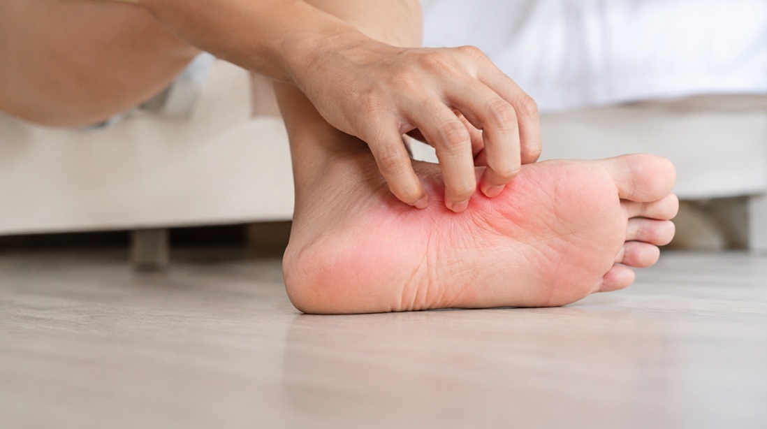 Penyebab Gatal di Telapak Kaki dan Cara Mengatasinya