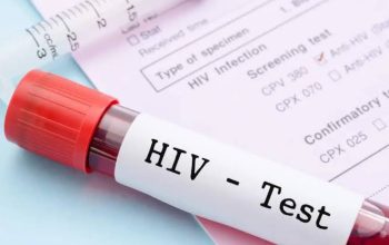 Apakah HIV Bisa Sembuh? Ini Penjelasan Terbarunya